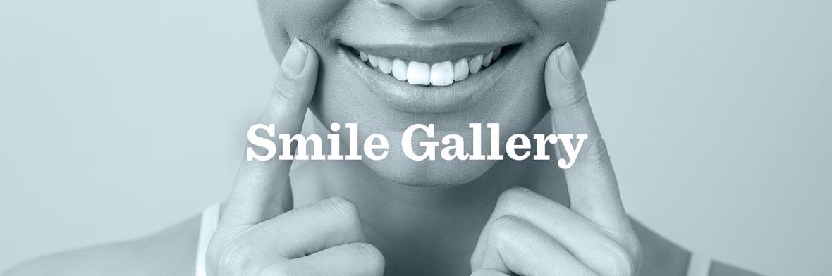Smile Gallery picture for Luker Dental Care